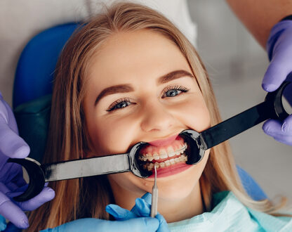 How Orthodontic Treatment Improves Overall Health Beyond Just a Straight Smile