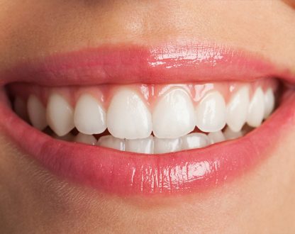 Keep Your Smile Merry and Bright: Expert Holiday Dental Care Tips for a Healthy New Year