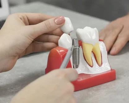 Can You Go Back to Work After Dental Implant Surgery?